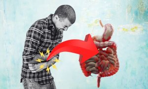Dor de Barriga que Não Some: Seria a Síndrome do Intestino Irritável?